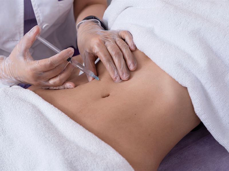 Aplicación de mesoterapia corporal por personal capacitado